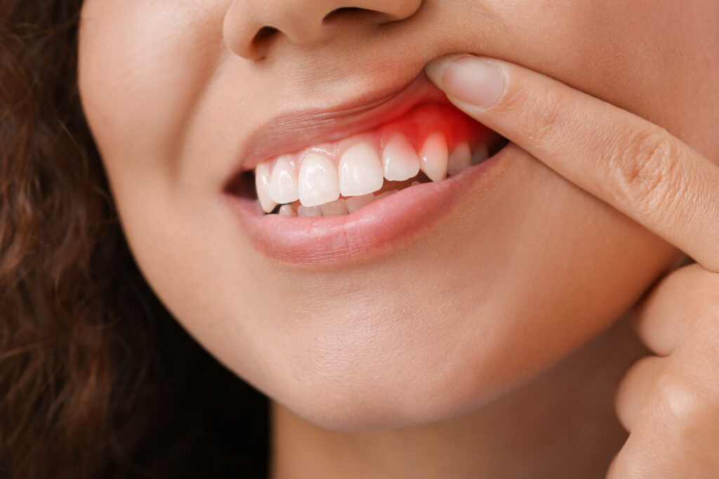 The Importance of Periodontal Health Why You Should Prioritize Your Gums