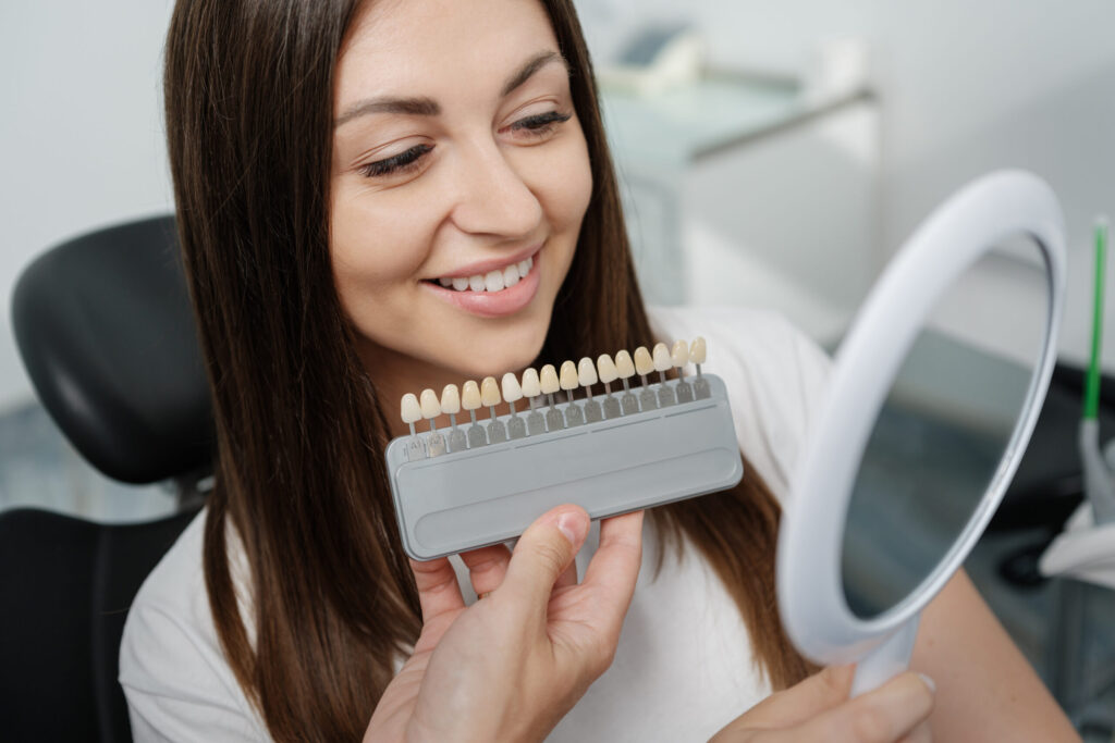 FAQs About Porcelain Veneers Answered by Our Dentists in Carmel Valley