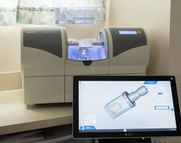 cerec same day crowns