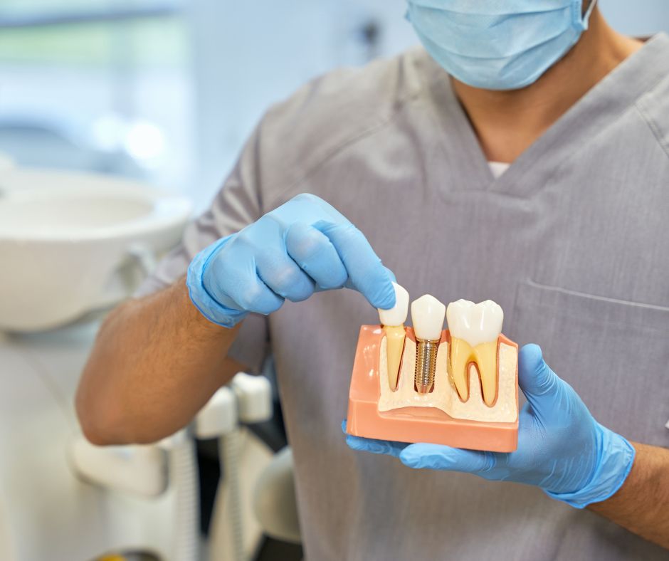 all-in 4 dental implants