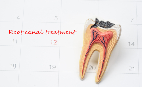 Tips to Care for a Root Canal Tooth